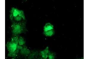 Anti-TBCC mouse monoclonal antibody (ABIN2455797) immunofluorescent staining of COS7 cells transiently transfected by pCMV6-ENTRY TBCC (RC203563). (TBCC antibody)