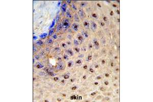 Formalin-fixed and paraffin-embedded human skin reacted with PAX3 Antibody (N-term), which was peroxidase-conjugated to the secondary antibody, followed by DAB staining. (Paired Box 3 antibody  (N-Term))