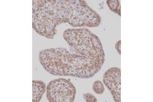Immunohistochemical analysis of (ABIN1539451 and ABIN2848995) on paraffin-embedded Human placenta tissue. (TET2 antibody  (N-Term))