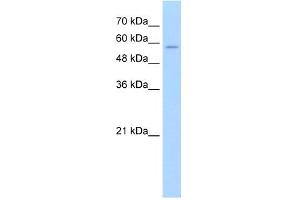 WB Suggested Anti-SLC22A16 Antibody Titration:  2.