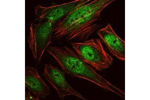 Immunofluorescence analysis of Hela cells using RUNX1 mouse mAb (green). (RUNX1 antibody)