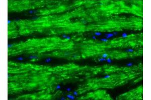 Image no. 1 for anti-Cardiotin antibody (ABIN959509) (Cardiotin antibody)