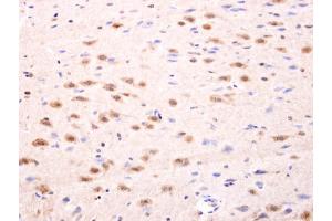IHC-P Image Islet 1 antibody detects Islet 1 protein at nucleus on rat fore brain by immunohistochemical analysis. (ISL1 antibody)