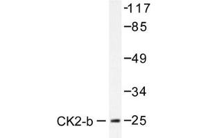 Image no. 1 for anti-Casein Kinase 2, beta (CSNK2B) antibody (ABIN272014) (CSNK2B antibody)