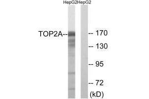 Western blot analysis of extracts from HepG2 cells, using TOP2A (Ab-1343) antibody. (Topoisomerase II alpha antibody  (Thr1343))