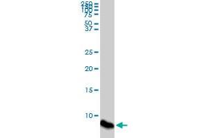 ATOX1 monoclonal antibody (M08), clone 4D6. (ATOX1 antibody  (AA 1-68))