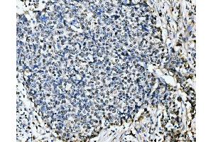 IHC analysis of MCM6 using anti-MCM6 antibody (ABIN7600038). (MCM6 antibody  (AA 14-821))
