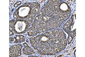 IHC analysis of Aconitase 2 using anti-Aconitase 2 antibody (ABIN7602770). (ACO2 antibody  (C-Term))