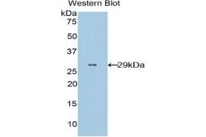 Western Blotting (WB) image for anti-CD36 (CD36) (AA 91-311) antibody (ABIN1859048) (CD36 antibody  (AA 91-311))
