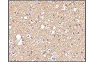Immunohistochemical staining of human brain tissue using AP30785PU-N SIRT2 antibody at 2. (SIRT2 antibody  (C-Term))