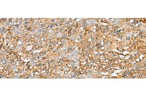 Immunohistochemistry of paraffin-embedded Human tonsil tissue using LGALS9 Polyclonal Antibody at dilution of 1:40(x200) (Galectin 9 antibody)