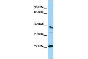 Western Blotting (WB) image for anti-Triggering Receptor Expressed On Myeloid Cells-Like 1 (TREML1) (Middle Region) antibody (ABIN2790139) (TREML1 antibody  (Middle Region))