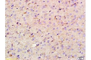 Immunohistochemistry (IHC) image for anti-Ionized Calcium-binding Adapter Molecule 1 (IBA1) (AA 51-147) antibody (ABIN685477)