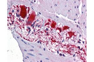 Colon, myenteric plexus (SSBP2 antibody  (N-Term))