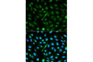 Immunofluorescence analysis of MCF-7 cells using AHSG antibody. (Fetuin A antibody)