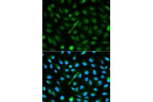 Immunofluorescence analysis of MCF-7 cells using AHSG antibody. (Fetuin A antibody)