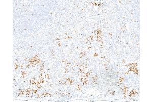 Immunohistochemistry (IHC) image for anti-Topo IIalpha (AA 650-700) antibody (ABIN7795794) (Recombinant Topo IIalpha (AA 650-700) antibody)
