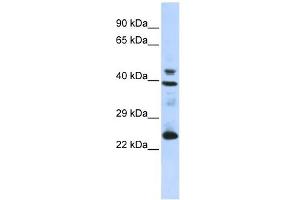 SEPP1 antibody used at 1 ug/ml to detect target protein. (Selenoprotein P antibody  (N-Term))