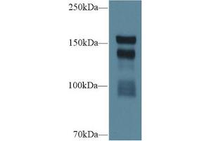 Western blot analysis of Rat Serum, using Rat THBS1 Antibody (1 µg/ml) and HRP-conjugated Goat Anti-Rabbit antibody (