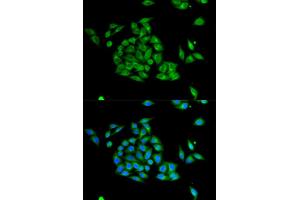 Immunofluorescence analysis of HeLa cell using PICK1 antibody. (PICK1 antibody  (AA 260-360))