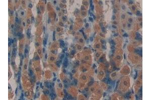 Immunohistochemistry (IHC) image for anti-Leukemia Inhibitory Factor Receptor alpha (LIFR) (AA 641-790) antibody (ABIN7437698)
