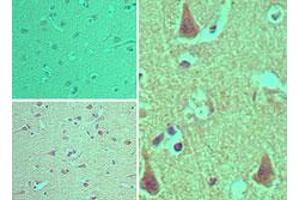 Image no. 1 for anti-ArfGAP with RhoGAP Domain, Ankyrin Repeat and PH Domain 2 (ARAP2) (AA 1670-1720) antibody (ABIN960081) (ARAP2 antibody  (AA 1670-1720))