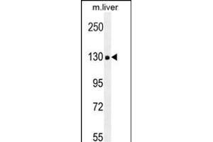 COL18A1 Antibody (Center) (ABIN654663 and ABIN2844359) western blot analysis in mouse liver tissue lysates (35 μg/lane). (COL18A1 antibody  (AA 1311-1339))