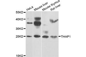 Western blot analysis of extracts of various cell lines, using THAP1 antibody (ABIN4905411) at 1:1000 dilution. (THAP1 antibody)