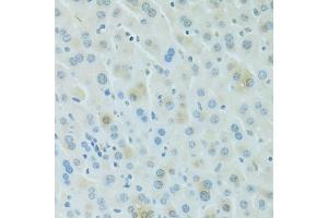 Immunohistochemistry of paraffin-embedded mouse liver using PDC antibody (ABIN6293719) at dilution of 1:100 (40x lens).