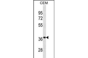TT Antibody (Center) (ABIN1881957 and ABIN2838927) western blot analysis in CEM cell line lysates (35 μg/lane). (TTPA antibody  (AA 82-108))