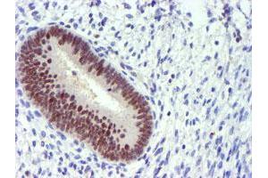 Immunohistochemical staining of paraffin-embedded Human endometrium tissue using anti-PDSS2 mouse monoclonal antibody. (PDSS2 antibody)