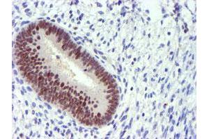 Immunohistochemical staining of paraffin-embedded Human endometrium tissue using anti-PDSS2 mouse monoclonal antibody.