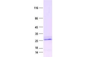 Validation with Western Blot (Proline Rich 15 Protein (PRR15) (DYKDDDDK Tag))