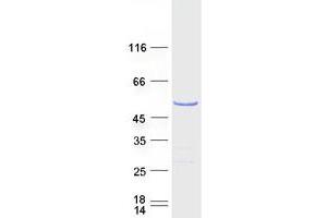 Validation with Western Blot