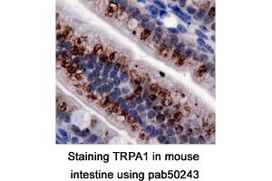 Image no. 2 for anti-Transient Receptor Potential Cation Channel, Subfamily A, Member 1 (TRPA1) (AA 1-100), (N-Term) antibody (ABIN363552)