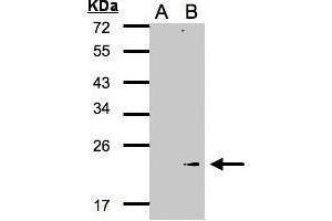 WB Image Western Blot analysis of GPX7 expression in transfected 293T cell line by GPX7 polyclonal antibody.