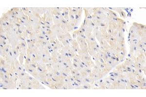 Detection of LEP in Bovine Cardiac Muscle Tissue using Polyclonal Antibody to Leptin (LEP) (Leptin antibody  (AA 29-160))