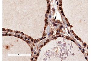 ABIN184783 (4µg/ml) staining of paraffin embedded Human Thyroid Gland. (PAX8 antibody  (N-Term))
