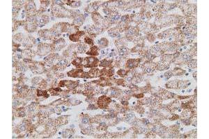 Immunohistochemical staining of paraffin-embedded Human liver tissue using anti-PECR mouse monoclonal antibody. (PECR antibody)