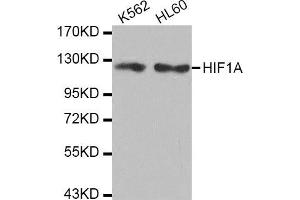 Western Blotting (WB) image for anti-Hypoxia Inducible Factor 1, alpha Subunit (Basic Helix-Loop-Helix Transcription Factor) (HIF1A) antibody (ABIN1980281)