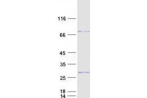 Validation with Western Blot (CHIC2 Protein (Myc-DYKDDDDK Tag))