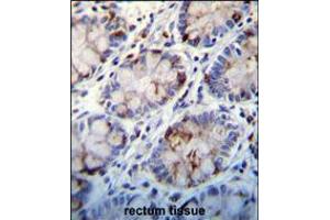 C1QC Antibody immunohistochemistry analysis in formalin fixed and paraffin embedded human rectum tissue followed by peroxidase conjugation of the secondary antibody and DAB staining. (C1QC antibody  (AA 93-120))