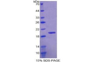 SDS-PAGE (SDS) image for RNA Binding Motif Protein 20 (RBM20) (AA 1089-1227) protein (His tag) (ABIN1099440) (RBM20 Protein (AA 1089-1227) (His tag))