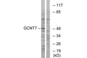 Western blot analysis of extracts from K562 cells, using GCNT7 antibody. (GCNT7 antibody)