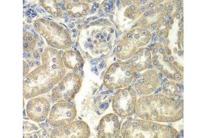 Immunohistochemistry of paraffin-embedded Rat kidney using ACSL5 Polyclonal Antibody at dilution of 1:100 (40x lens). (ACSL5 antibody)