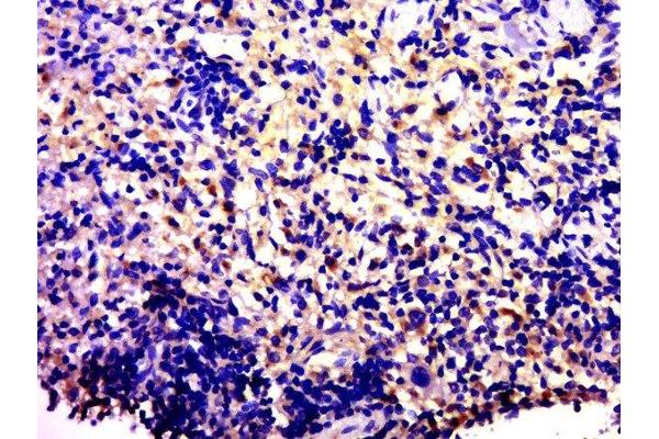BLOC1S4 antibody