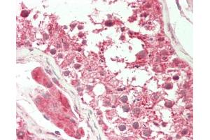 Human Testis: Formalin-Fixed, Paraffin-Embedded (FFPE). (KAT5 antibody  (Biotin))