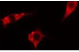 ABIN6267570 staining Hela cells by IF/ICC. (ADAM17 antibody  (pThr735))