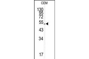 Western blot analysis of KLF5 antibody in CEM cell line lysates (35ug/lane) (KLF5 antibody  (AA 127-156))