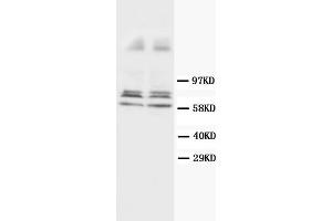 Western Blotting (WB) image for anti-Glial Fibrillary Acidic Protein (GFAP) antibody (ABIN1107345) (GFAP antibody)